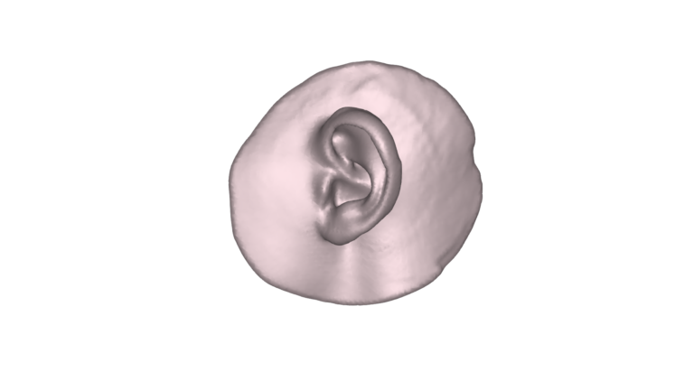 Ear-1