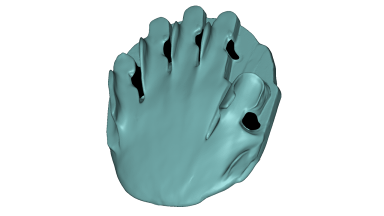hand-mold-1-metaphase