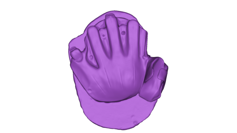 hand-mold-2-metaphase